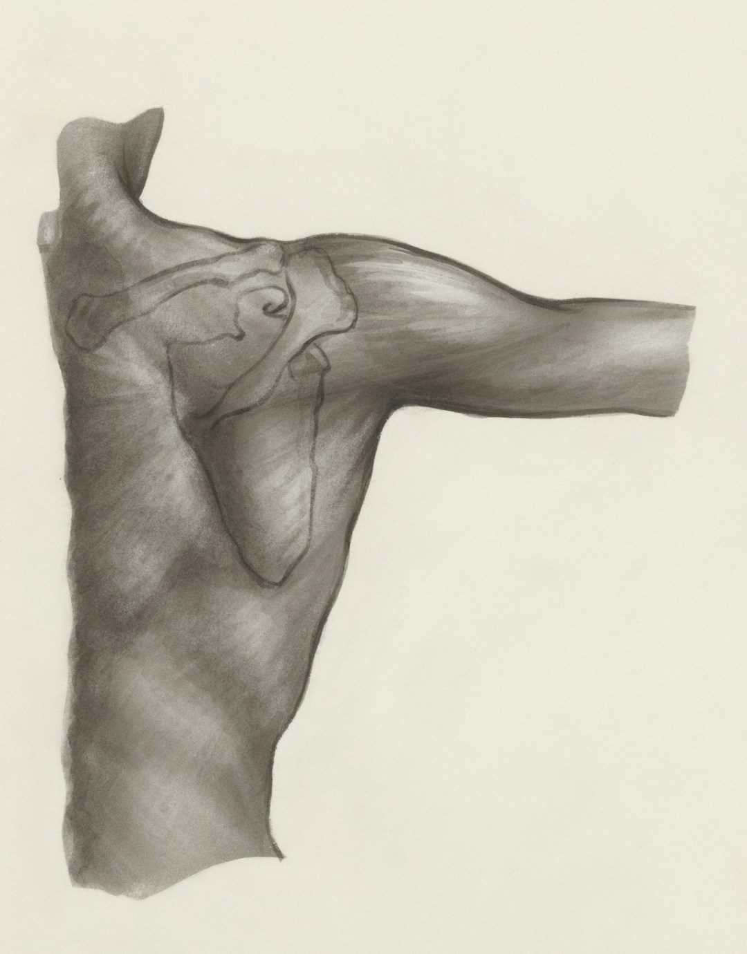 Frozen Shoulder (