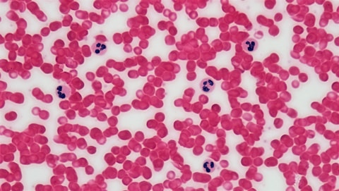 Connective Tissue: Human Blood Leukocyte Survey