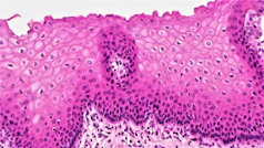 Epithelial Tissues: Stratified Squamous Epithelium