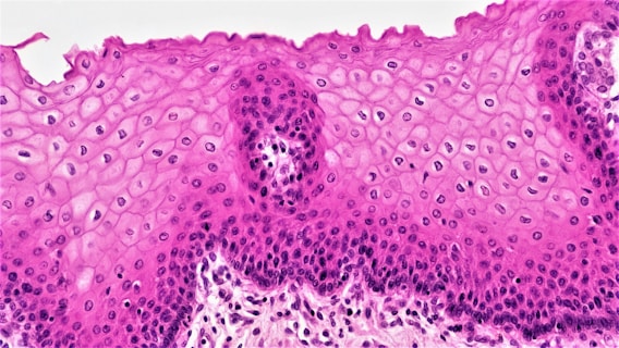 Epithelial Tissues: Stratified Squamous Epithelium