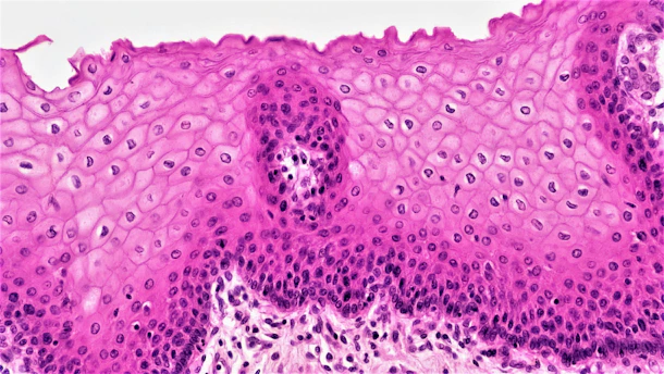 Epithelial Tissues: Stratified Squamous Epithelium