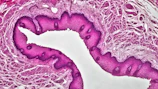 Epithelial Tissues: Stratified Squamous Epithelium