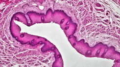 Histology slide showing stained tissue under a microscope for pathology analysis.