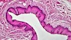 Epithelial Tissues: Stratified Squamous Epithelium