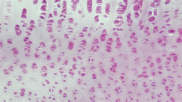 Connective Tissue: Developing Hyaline Cartilage