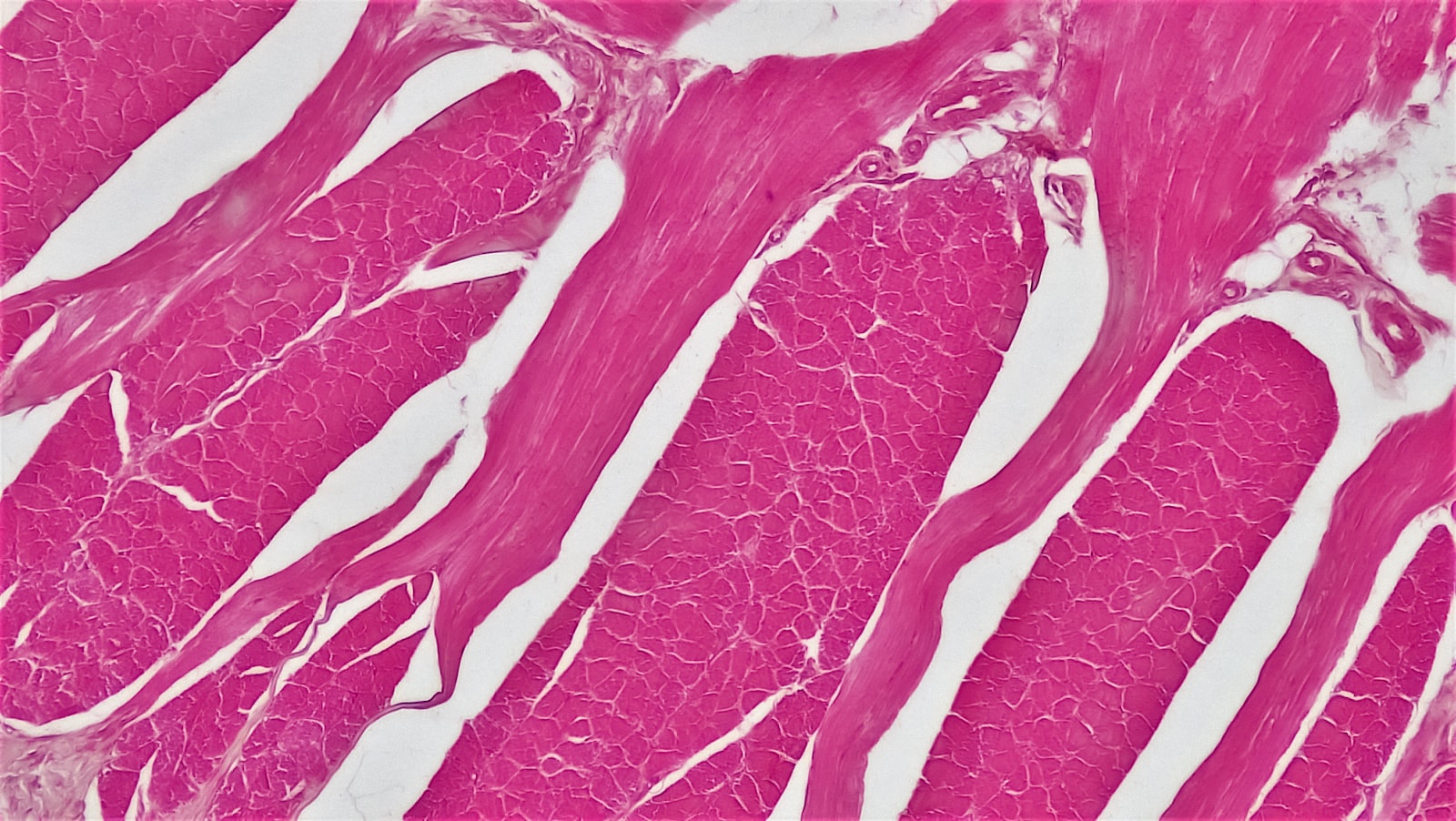 Cross-section of skeletal muscle tissue, the kind of biopsy analysis used to confirm fiber changes in the Becker muscular dystrophy follistatin gene-therapy trial