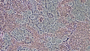 Proliferation of Adipocytes in Adult Parathyroid Gland by Phase Contrast
