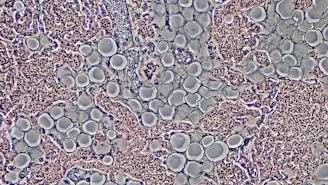 Proliferation of Adipocytes in Adult Parathyroid Gland by Phase Contrast
