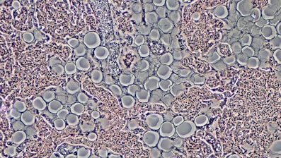 Proliferation of Adipocytes in Adult Parathyroid Gland by Phase Contrast