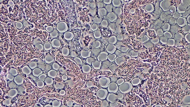 Proliferation of Adipocytes in Adult Parathyroid Gland by Phase Contrast