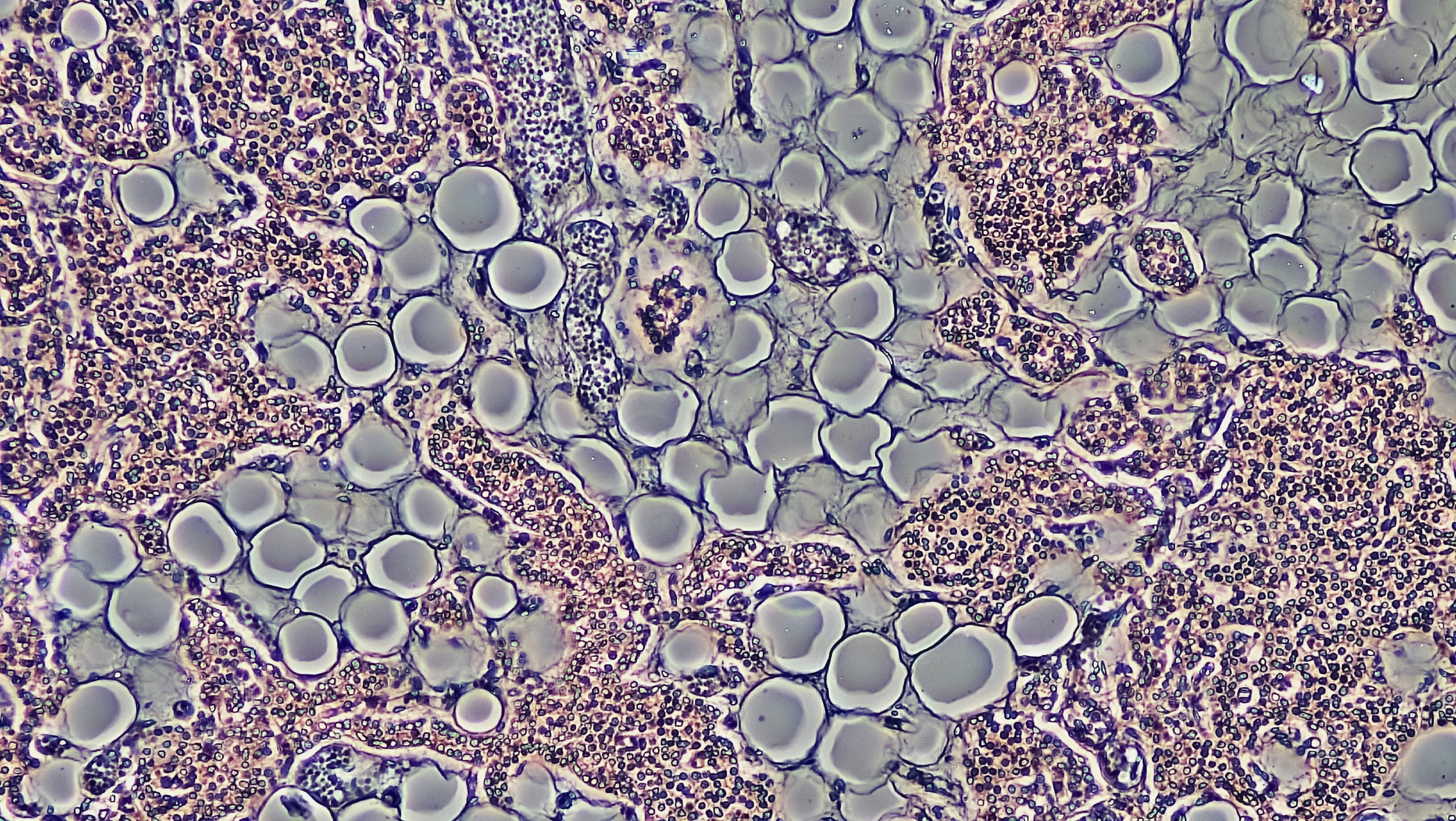 Proliferation of Adipocytes in Adult Parathyroid Gland by Phase Contrast. cross section: human parathythyroid gland magnification: 100x phase contrast hematoxylin eosin stain https://www.flickr.com/photos/146824358@N03/46608134175/in/album-72157666241437517/