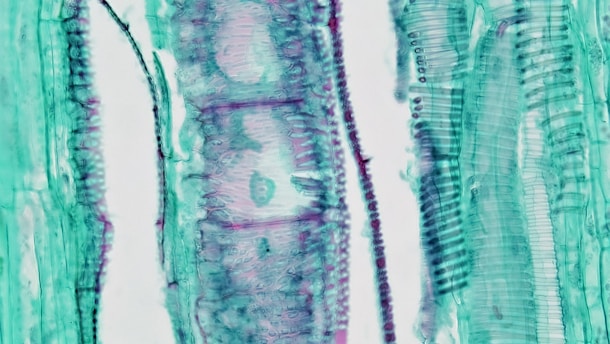 Herbaceous Dicot Stem: Tangential Section