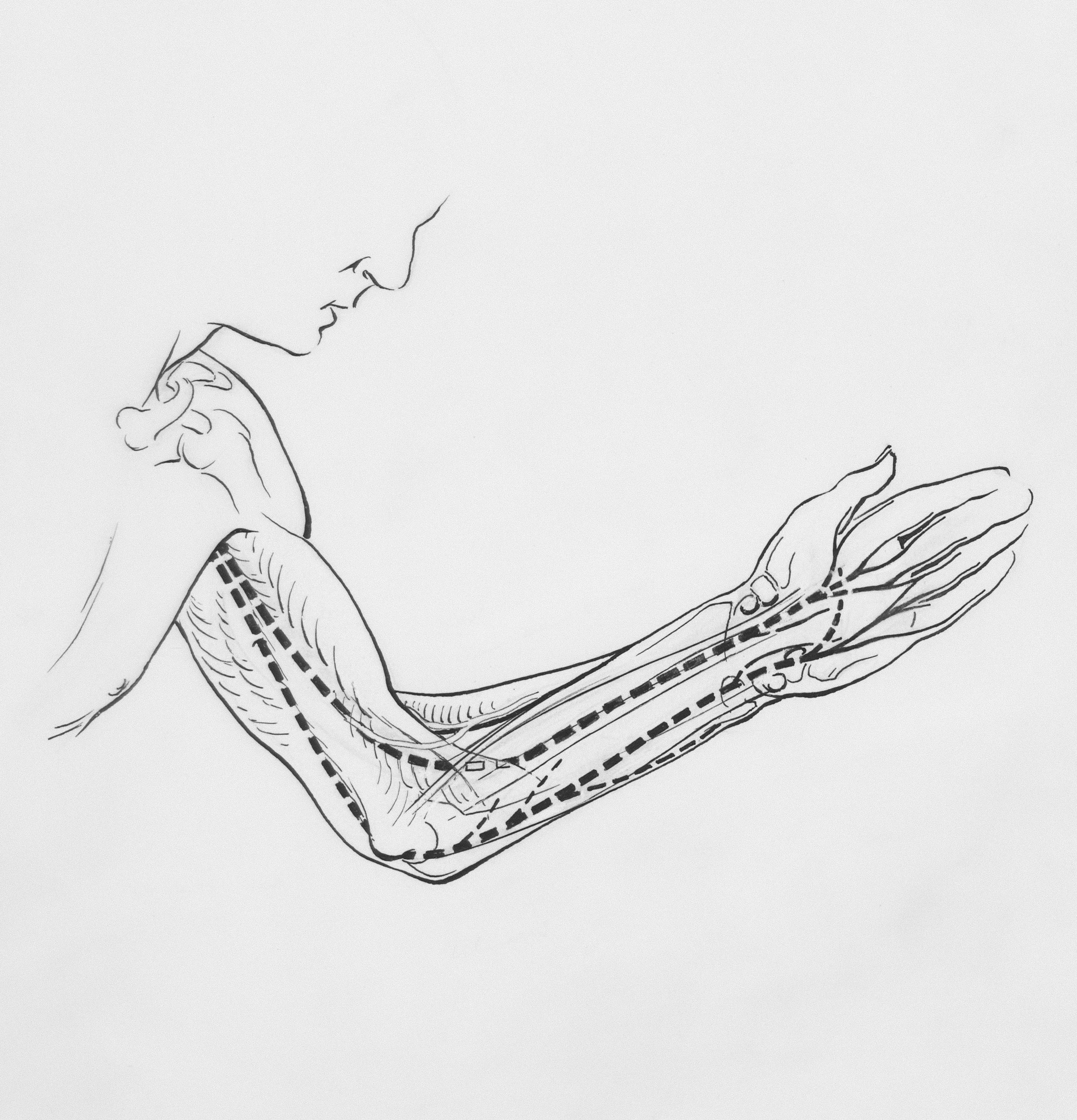 Forearm physical therapy exercise for tennis elbow recovery