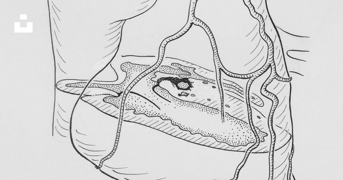 The heart and major arteries photo – Free Medicine Image on Unsplash