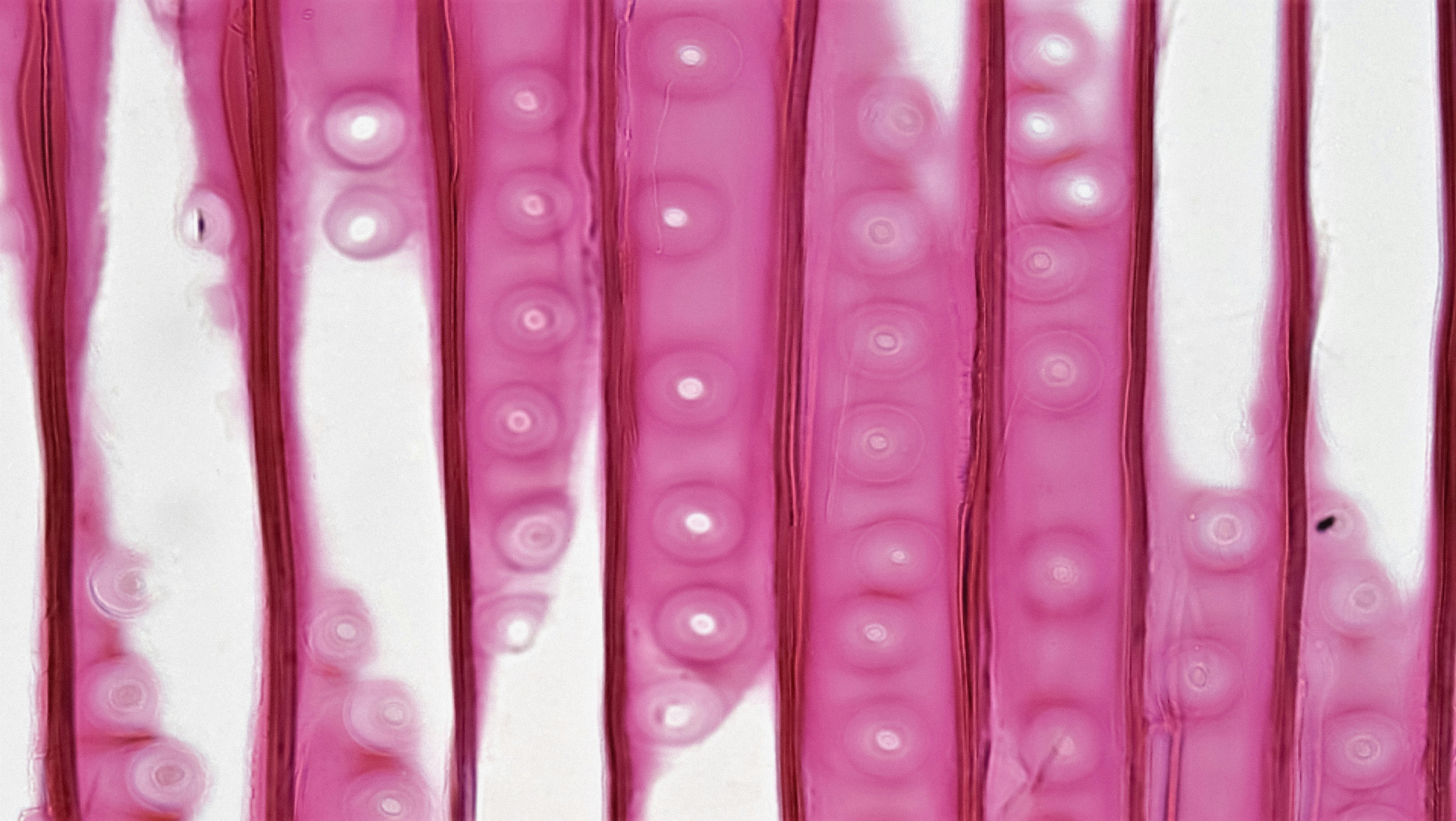Gymnosperm Stem: Circular Bordered Pits in Pinus Wood