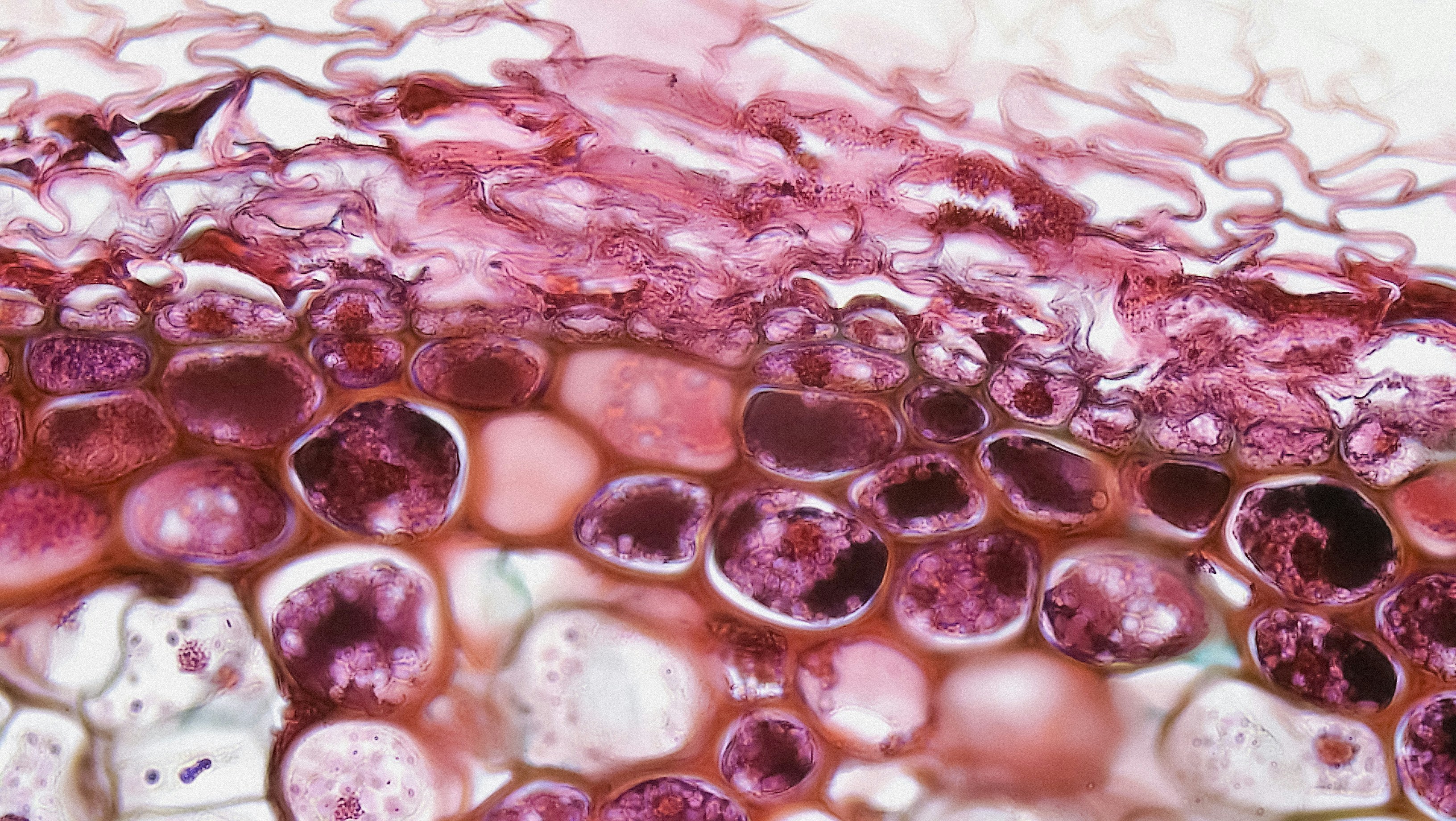 Gymnosperm Stem: Cork in Three Year Pinus