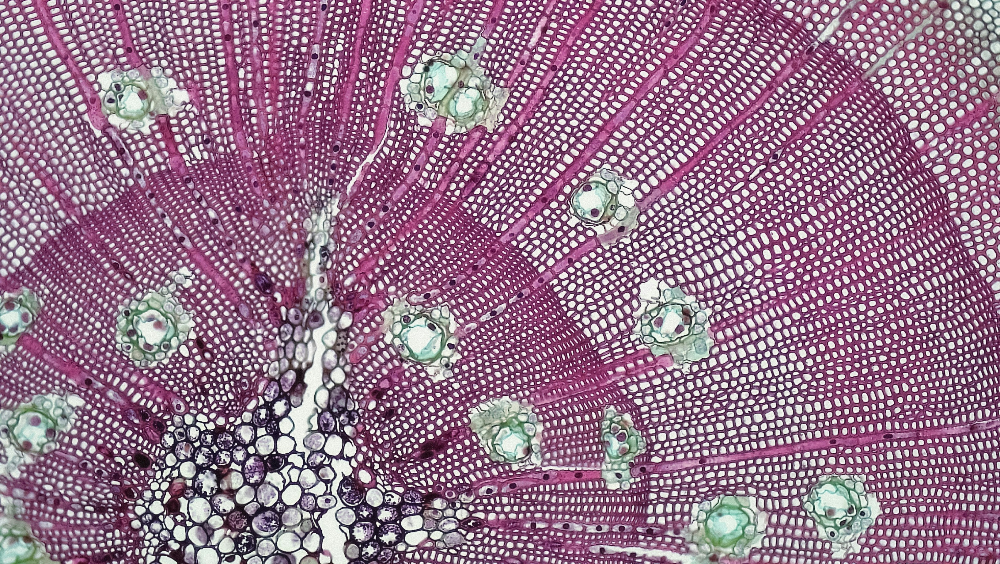 Gymnosperm Stem: Annual Rings in Three Year Pinus