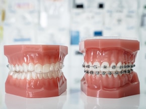 A model of a teeth with braces and braces