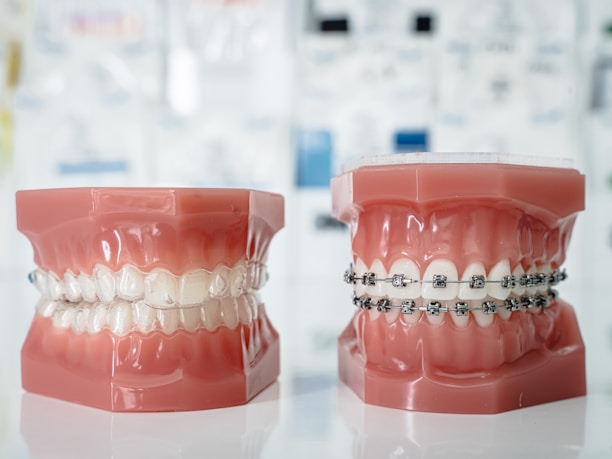 A model of a teeth with braces and braces