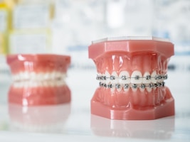 A close up of a tooth with braces on it