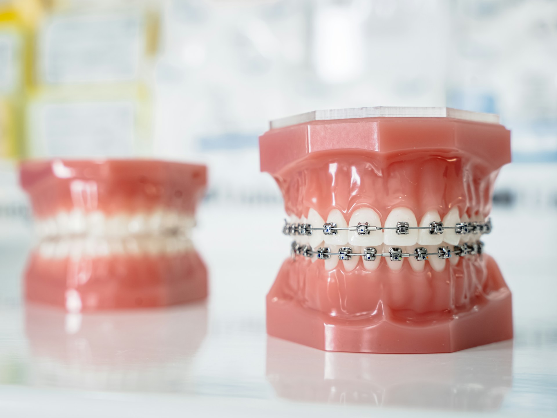 A close up of a tooth with braces on it
