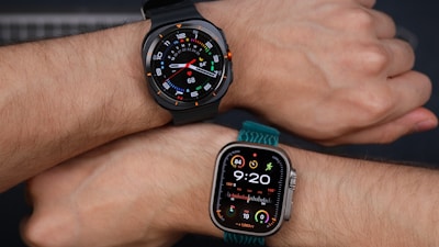 A couple of people that are holding onto some wrist watches
