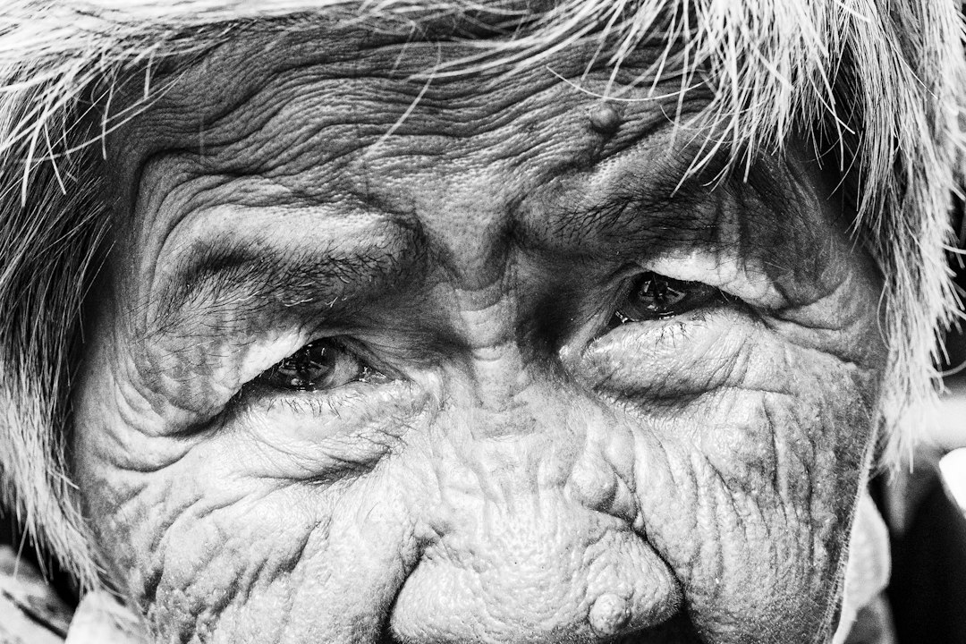 layers of skin and effects of aging - best skin treatment for aging skin layers of skin and effects of aging - best skin treatment for aging skin