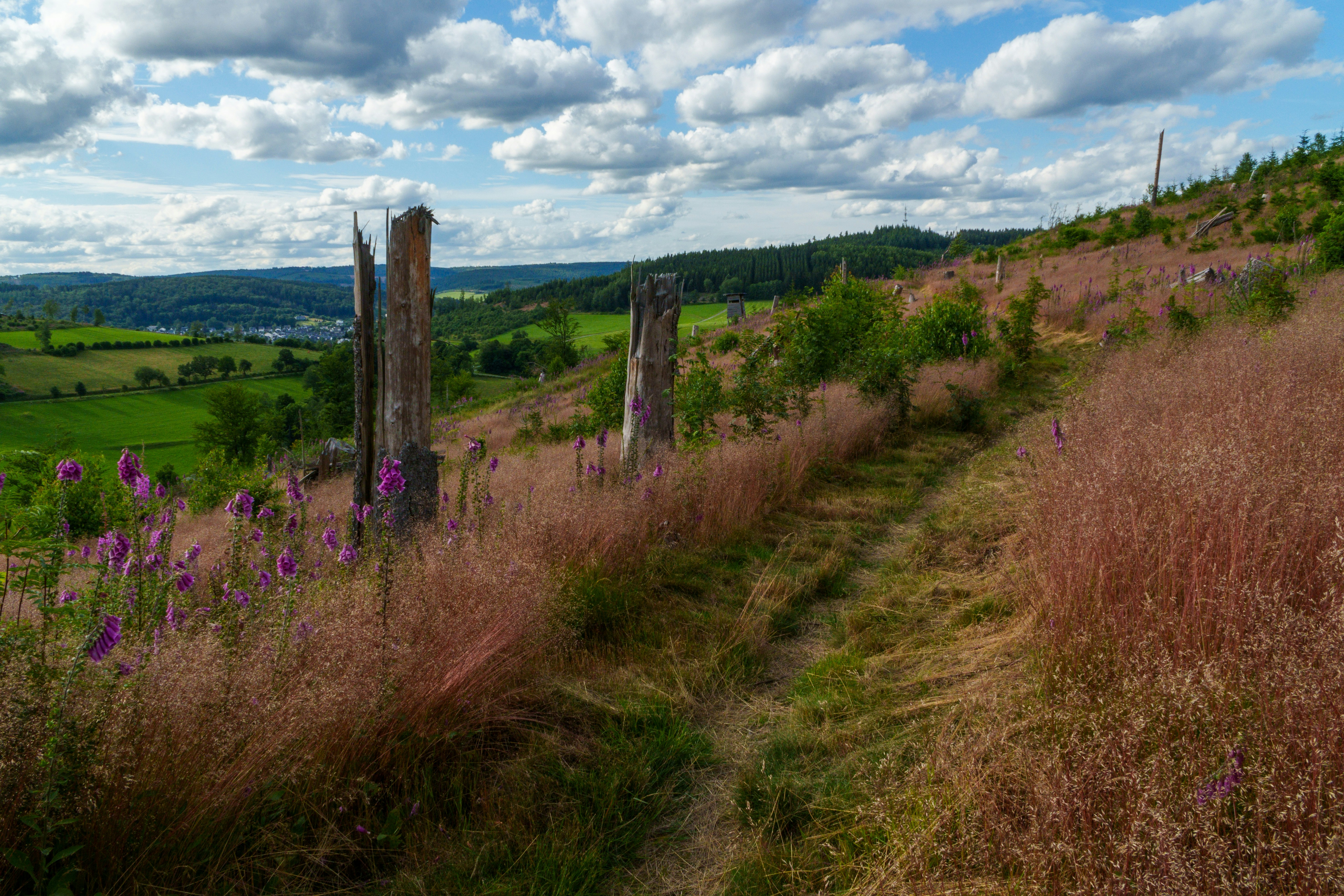 Boosting Blood Flow for Better Dialysis Success
