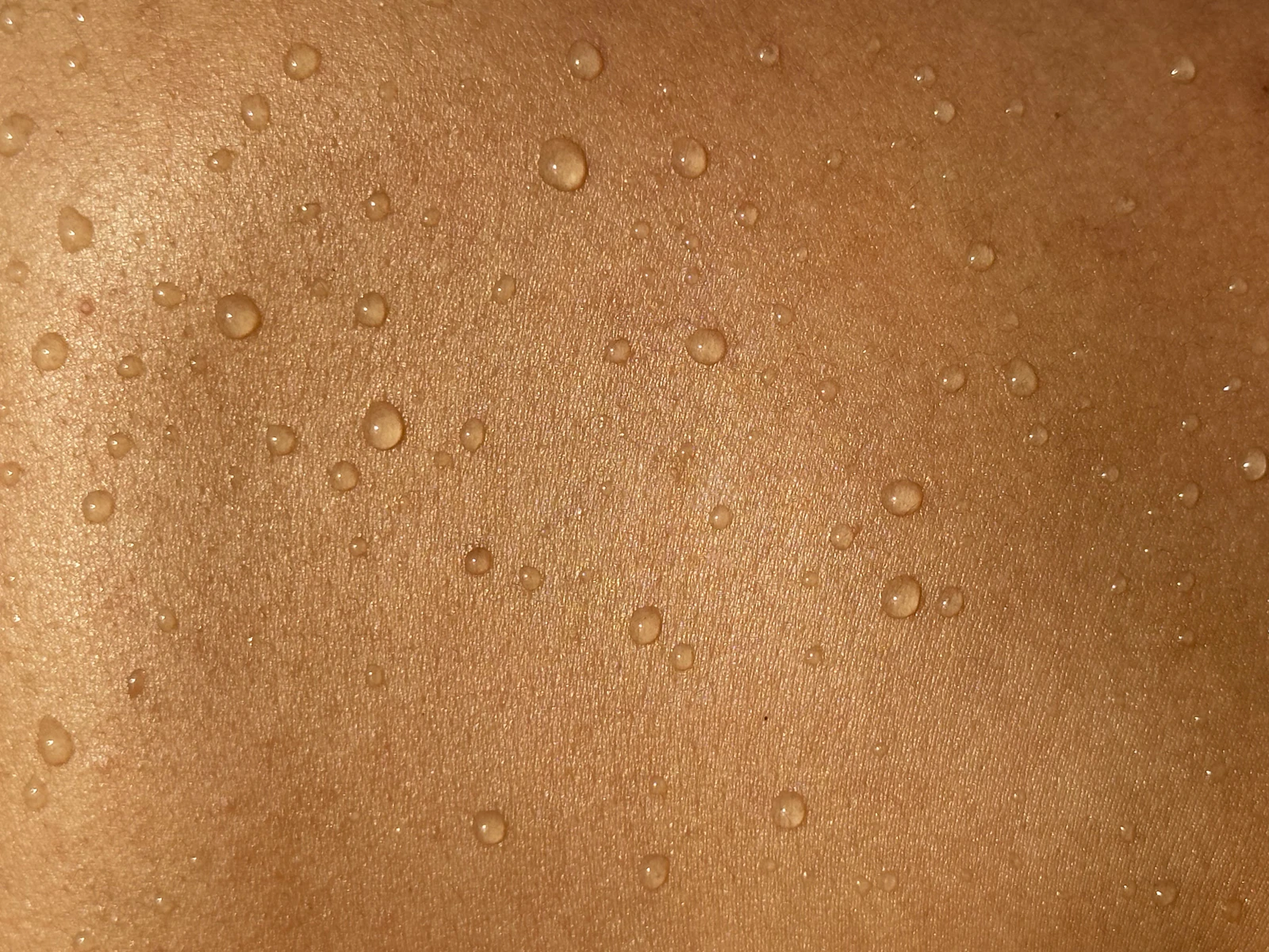 Calm editorial close-up of a back in warm natural light — a stand-in for a professional skin check