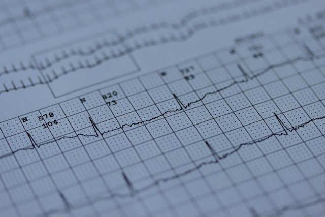 EKG-Ausdruck im Detail