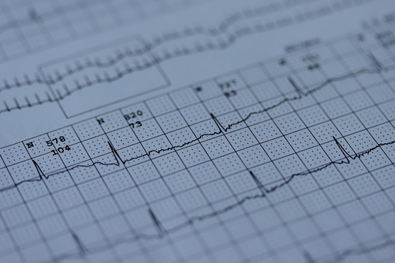 EKG-lelet szótár: mit jelent a sinus ritmus, az ST-eleváció és a szár-blokk?