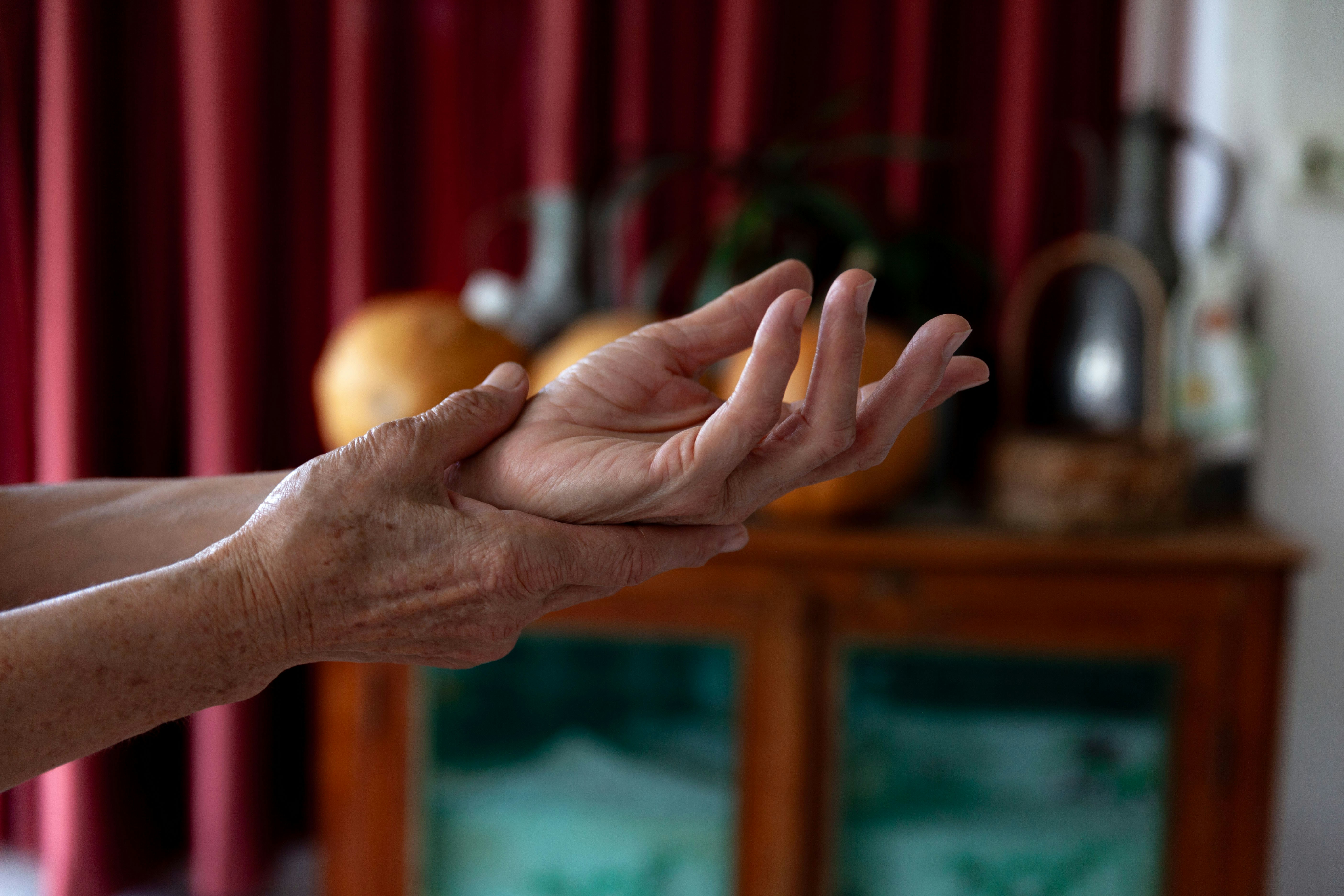 류마티스 관절염 증상