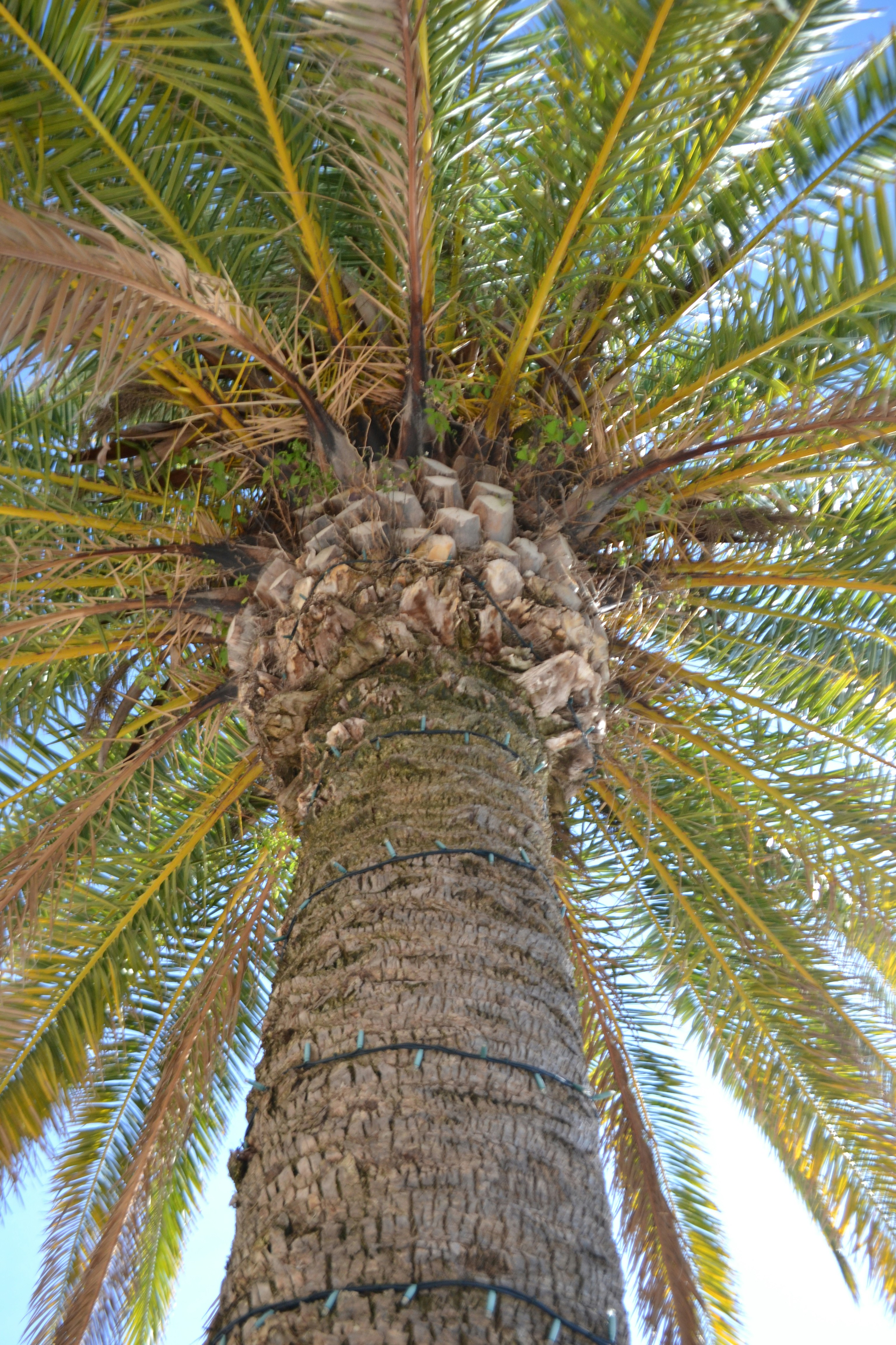 손바닥통증위치