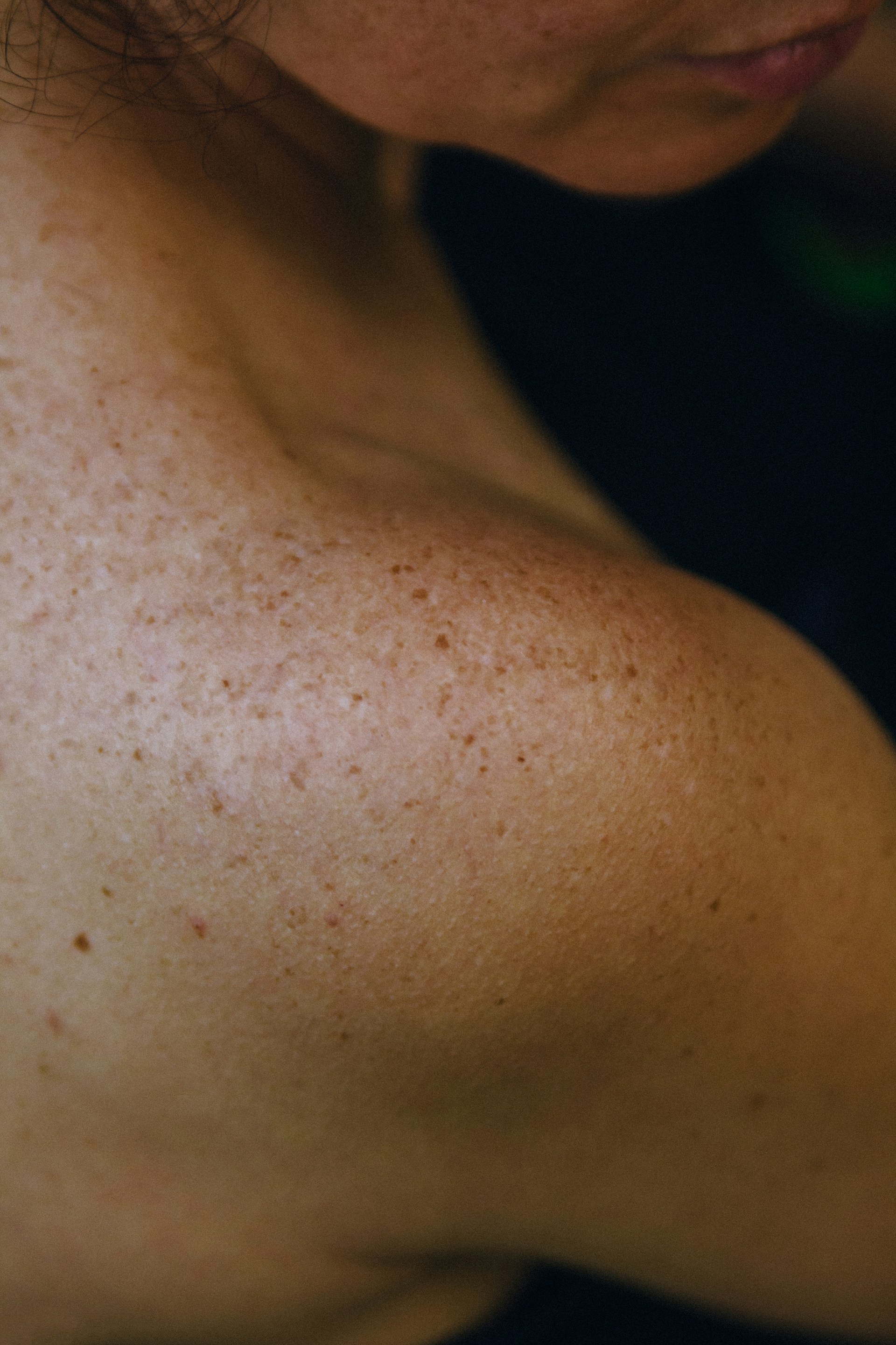 A close up of a woman with freckles on her arm