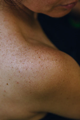 A close up of a woman with freckles on her arm