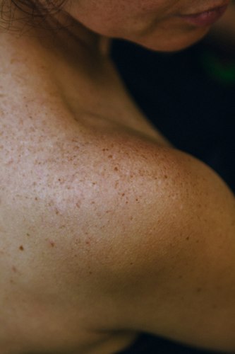 Smartphone camera capturing a close-up photo of skin, held at arm's length
