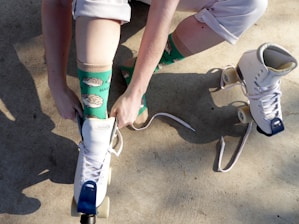 A person with a broken leg and a broken skateboard