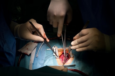 Kidney Transplant Surgery