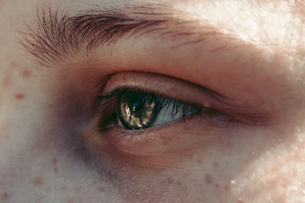 Close-up of natural skin texture with freckles