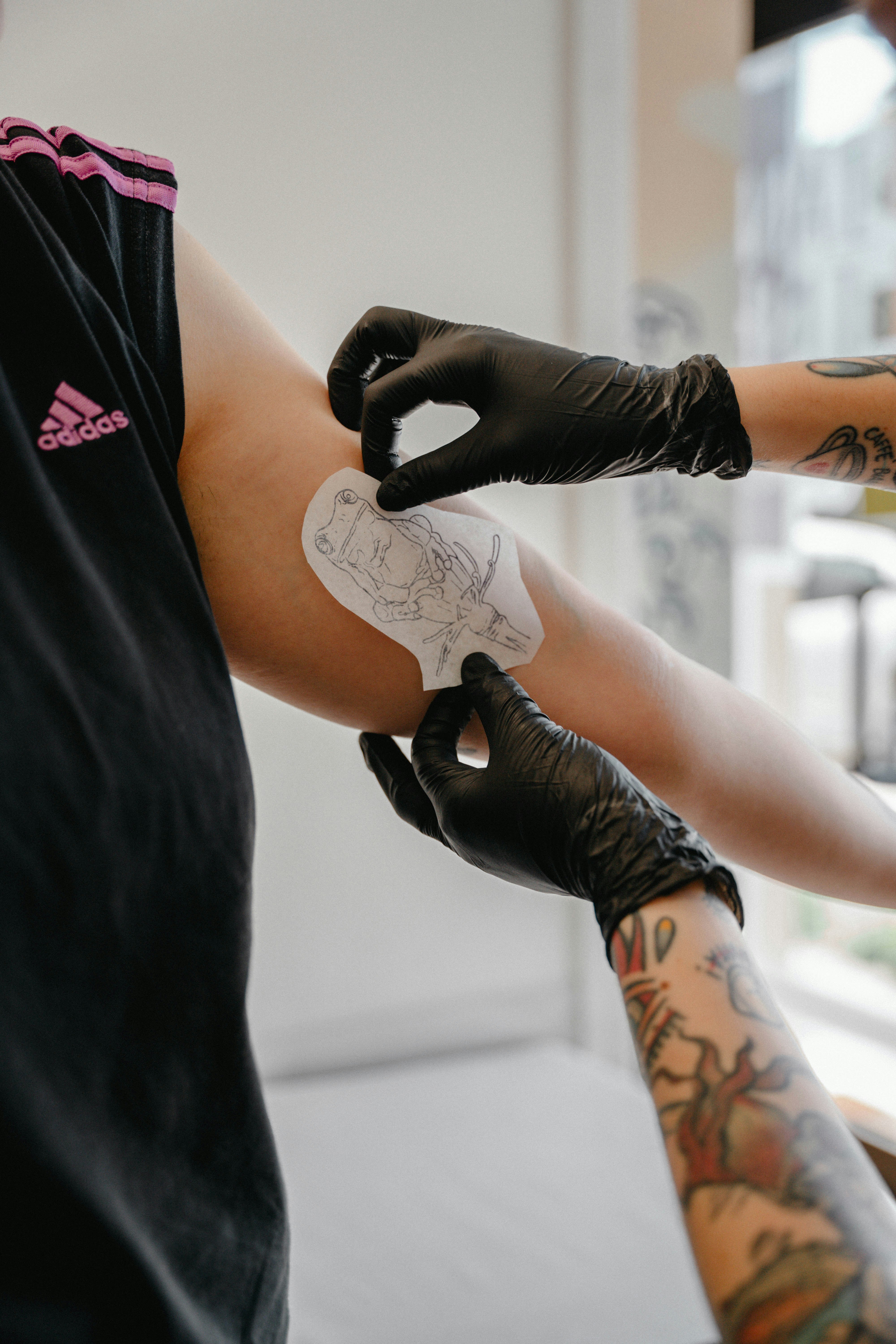 Image of a person preparing for a laser hair removal session