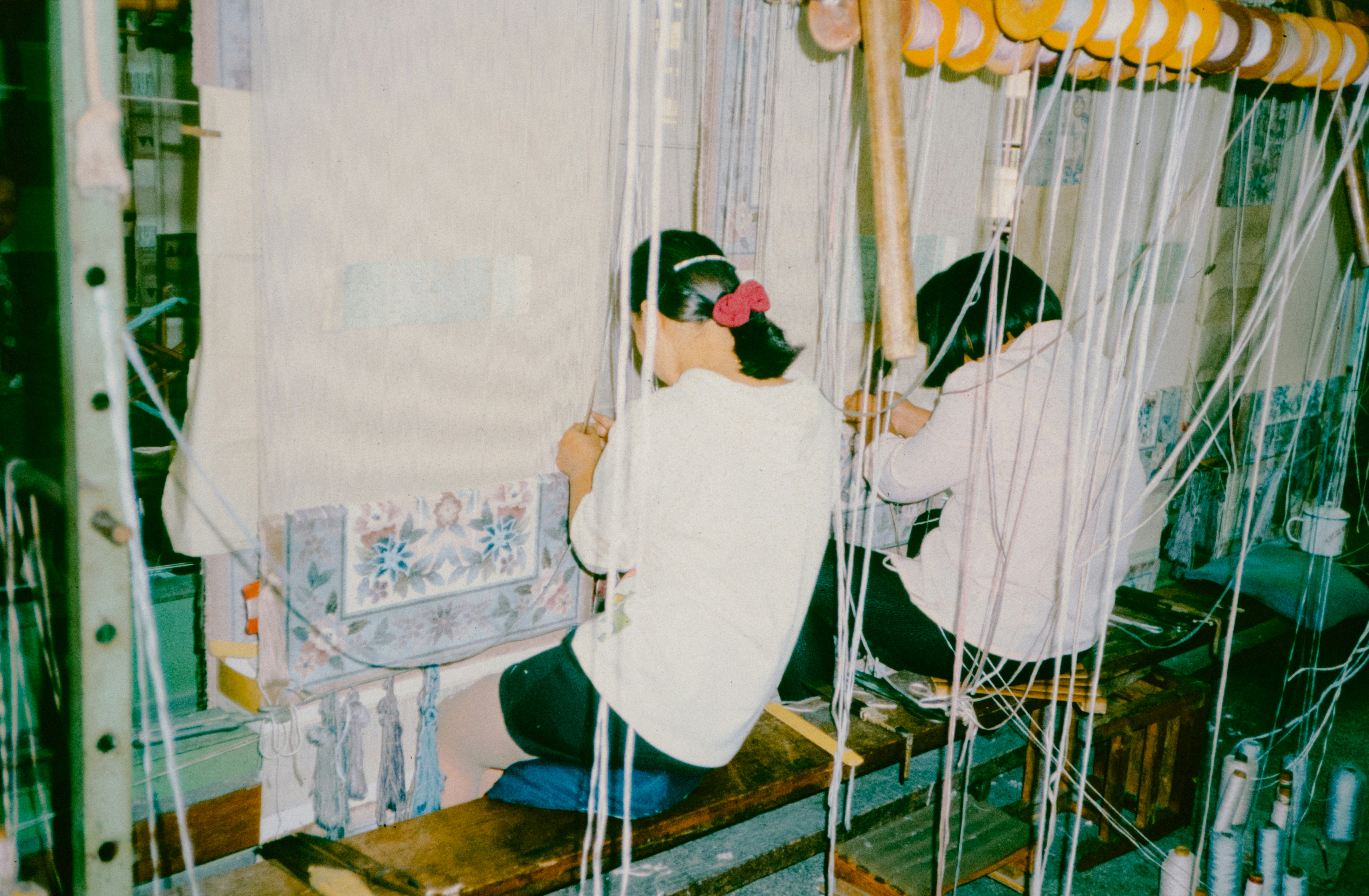Delayed Awakening After Brain Aneurysm Surgery: Understanding the Causes and Care