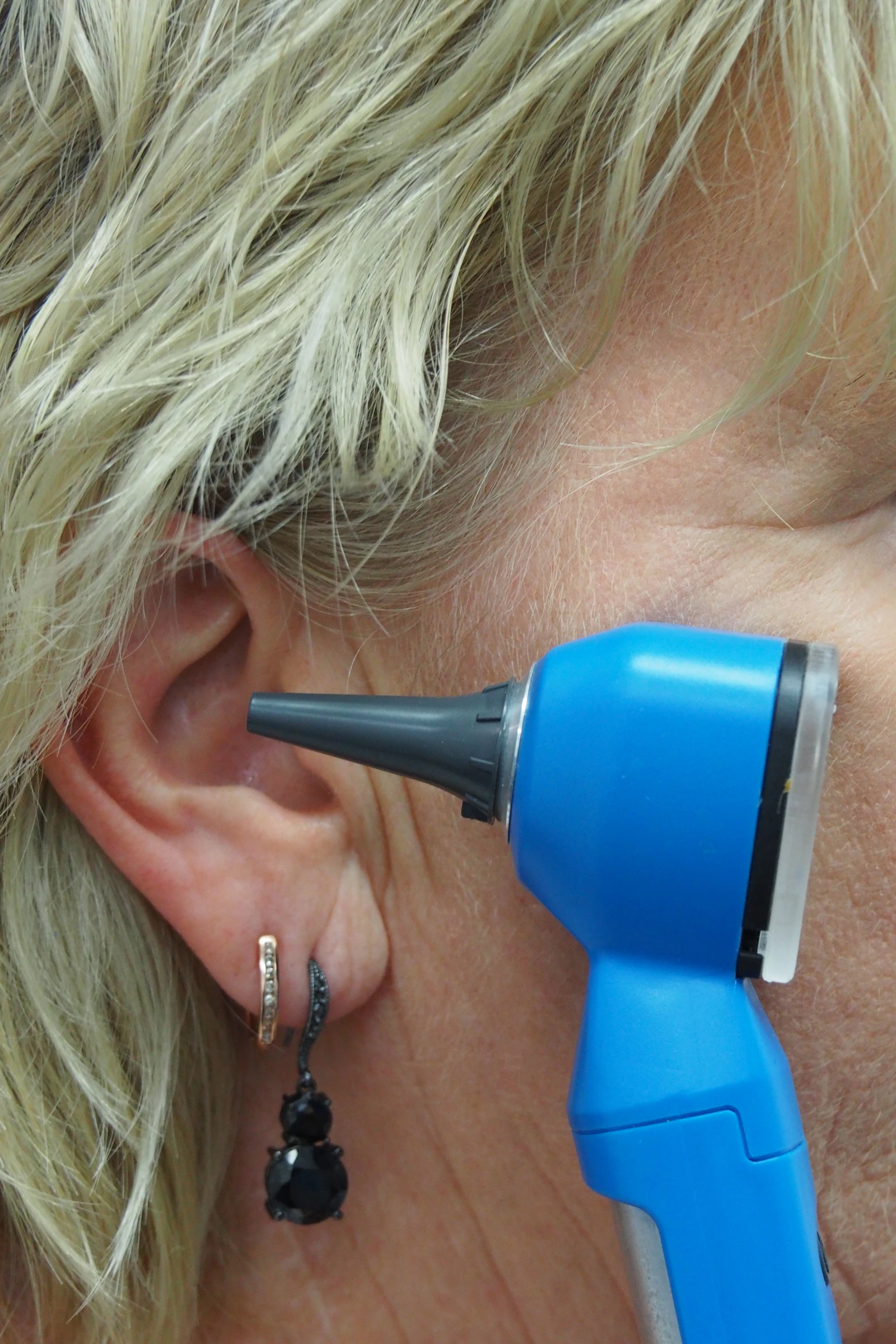 A doctor using an otoscope to examine a patient's ear