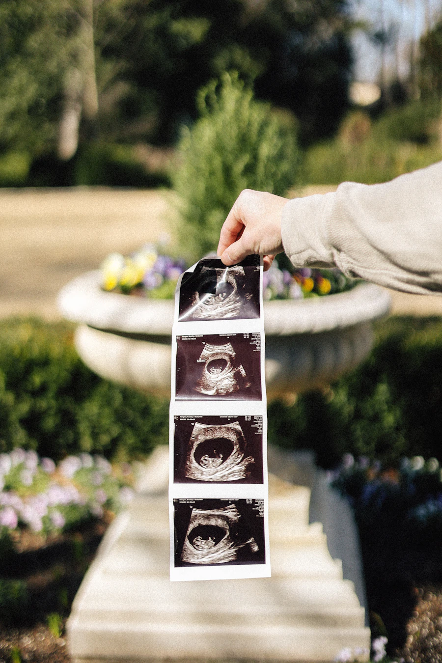 Hands holding ultrasound photos of a baby