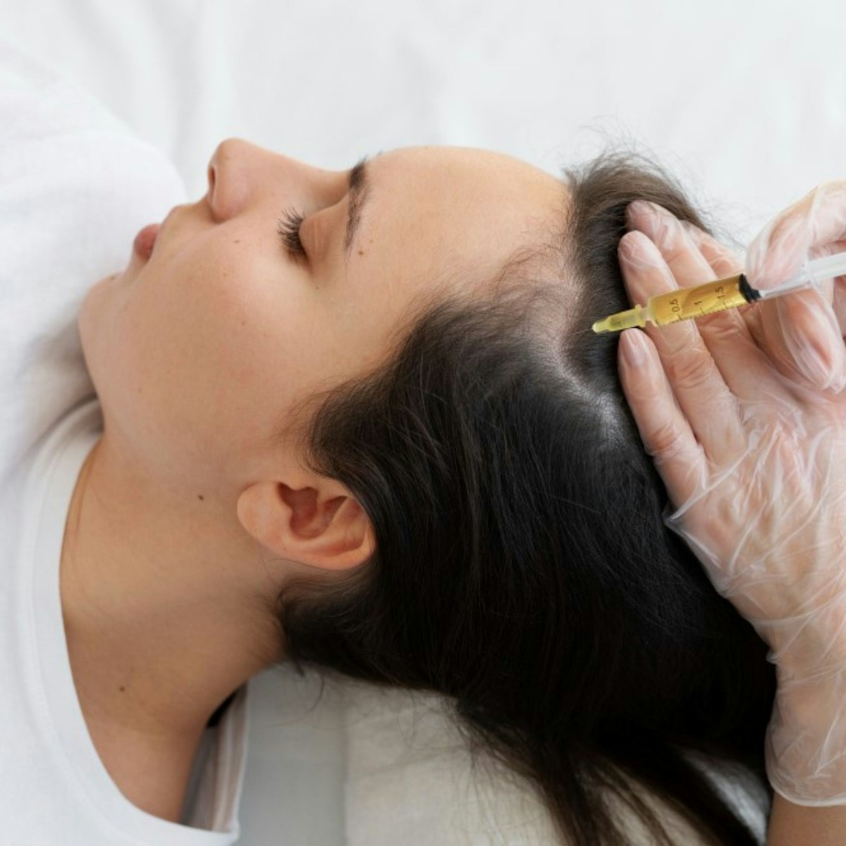 PRP for hair loss image background image