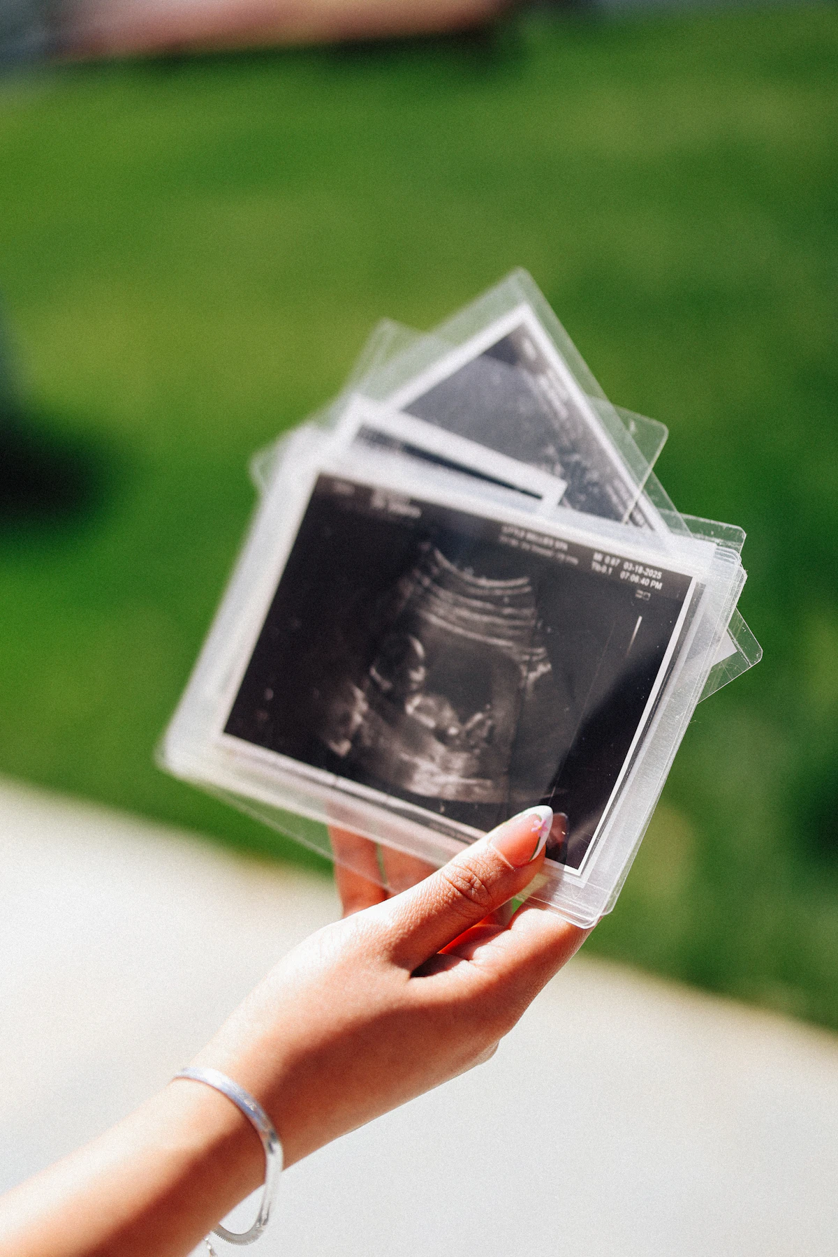A hand holding printed ultrasound images of a baby
