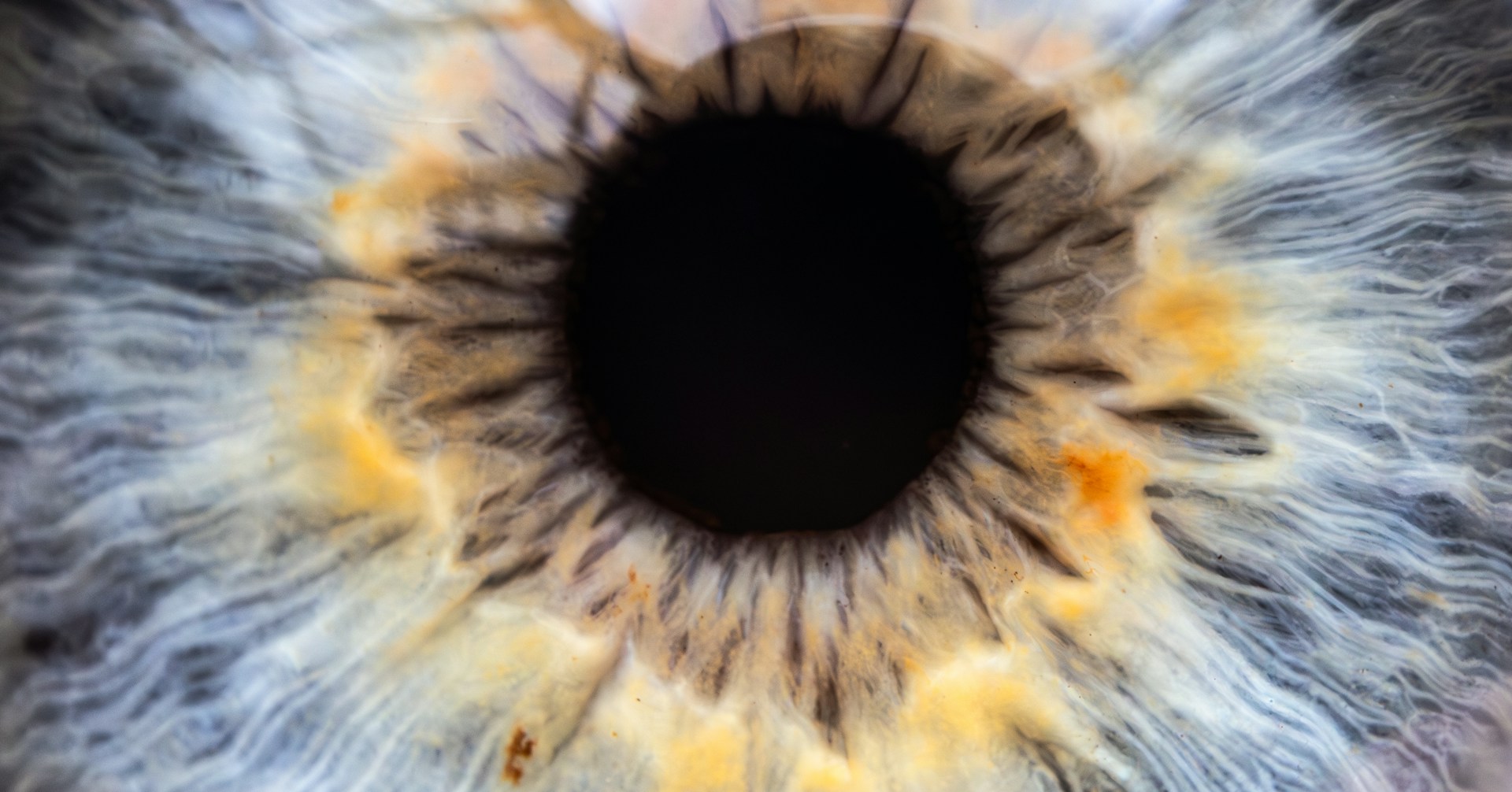 A close-up view of an eye's iris.