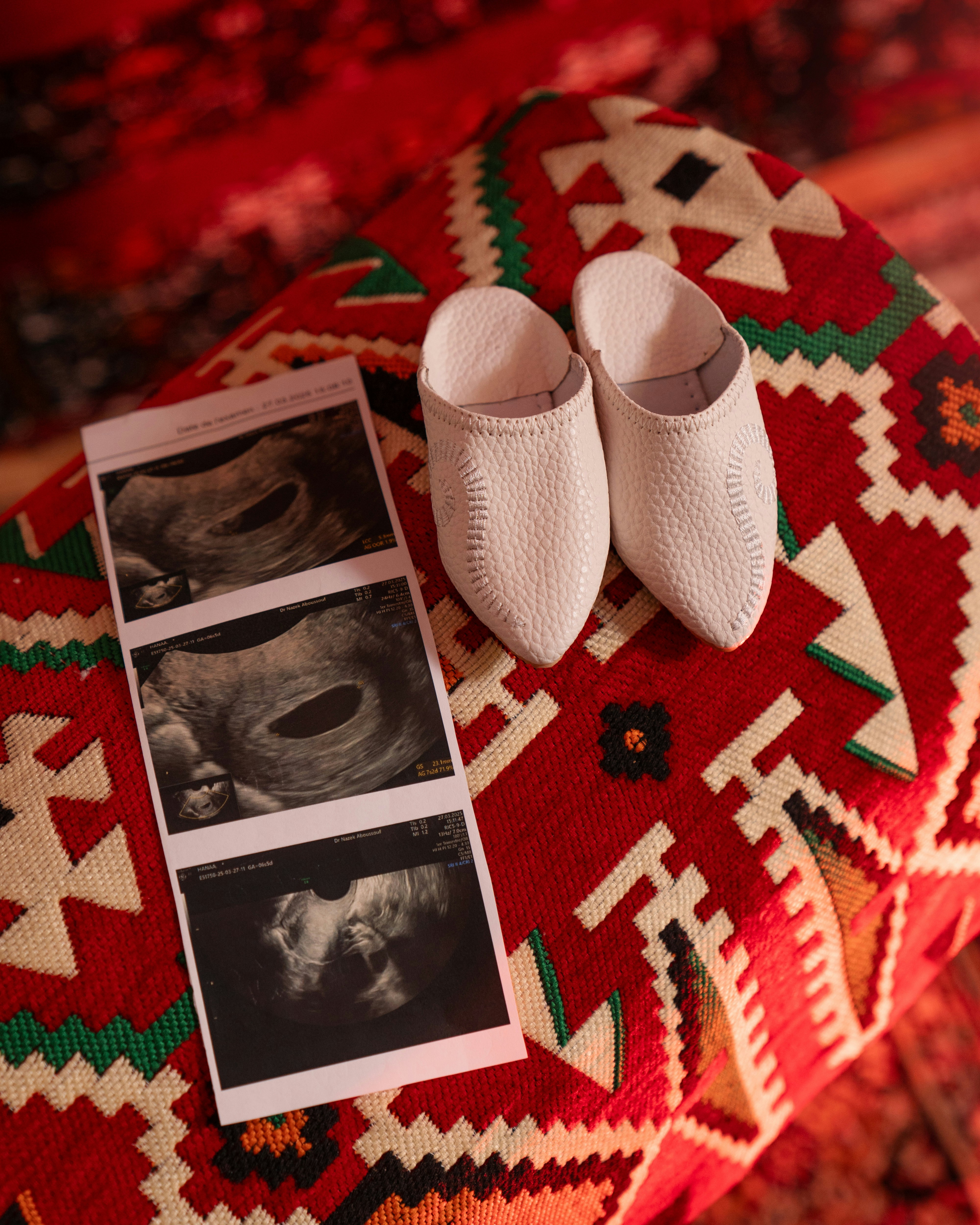 Baby shoes and ultrasound images on a vibrant rug.