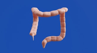 The image shows a 3D model of a colon.