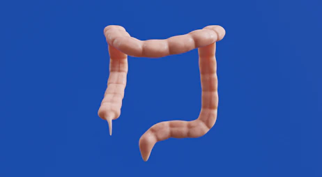 The image shows a 3D model of a colon