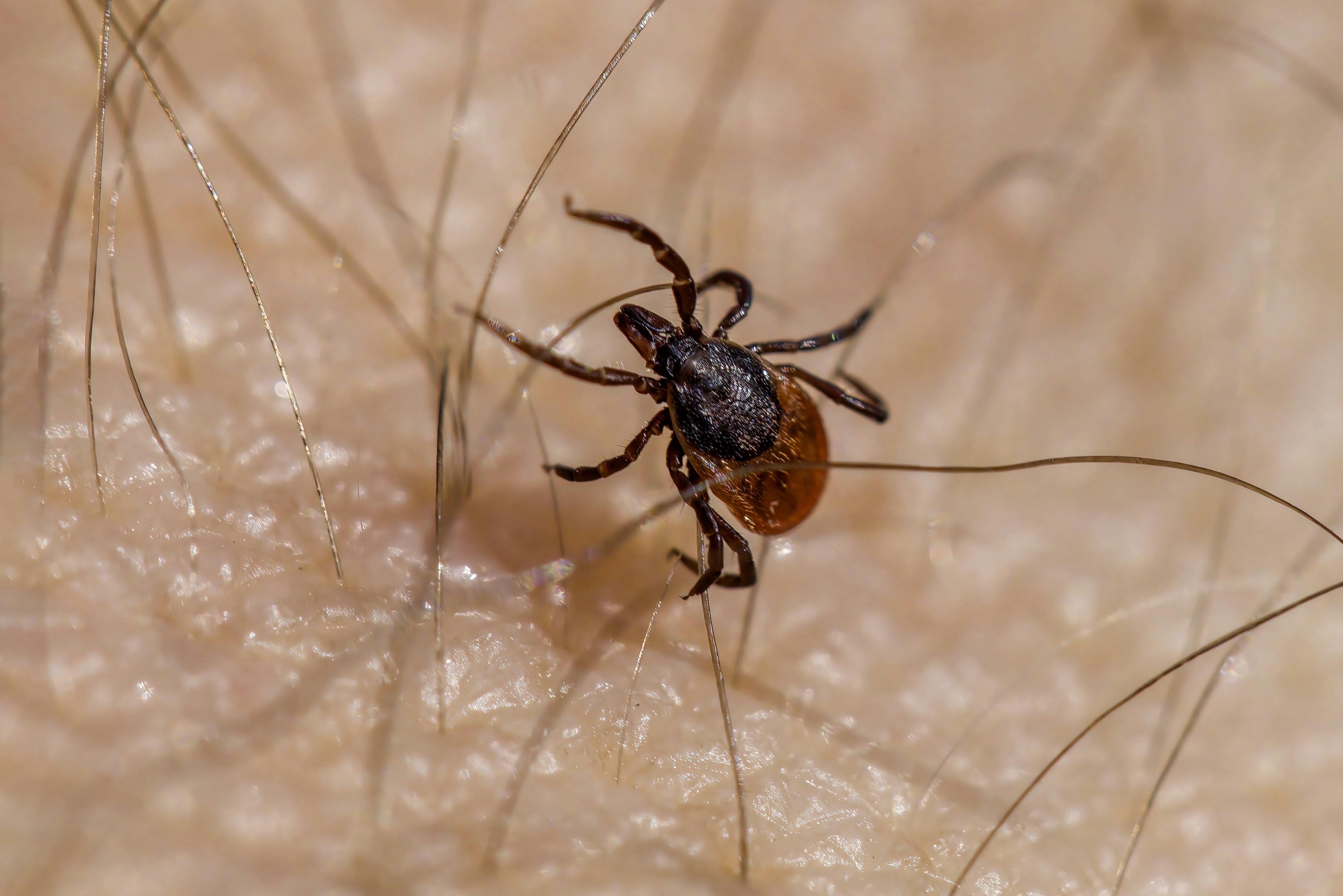 Ixodes scapularis or Deer tick that causes Lymes Disease.